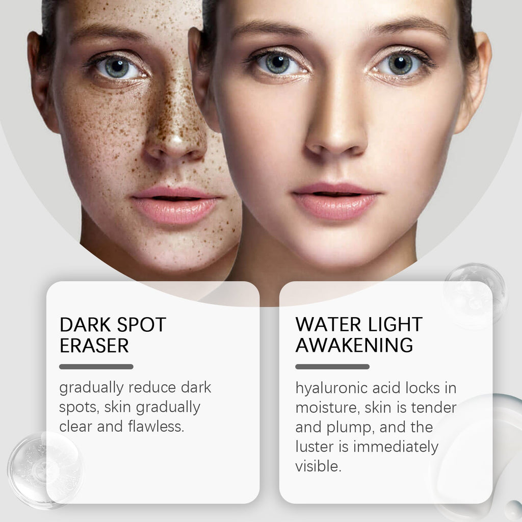 Dark Spot Repair Lotion Moisturizes And Hydrates Facial Skin With Skin Care Spot Repair Lotion