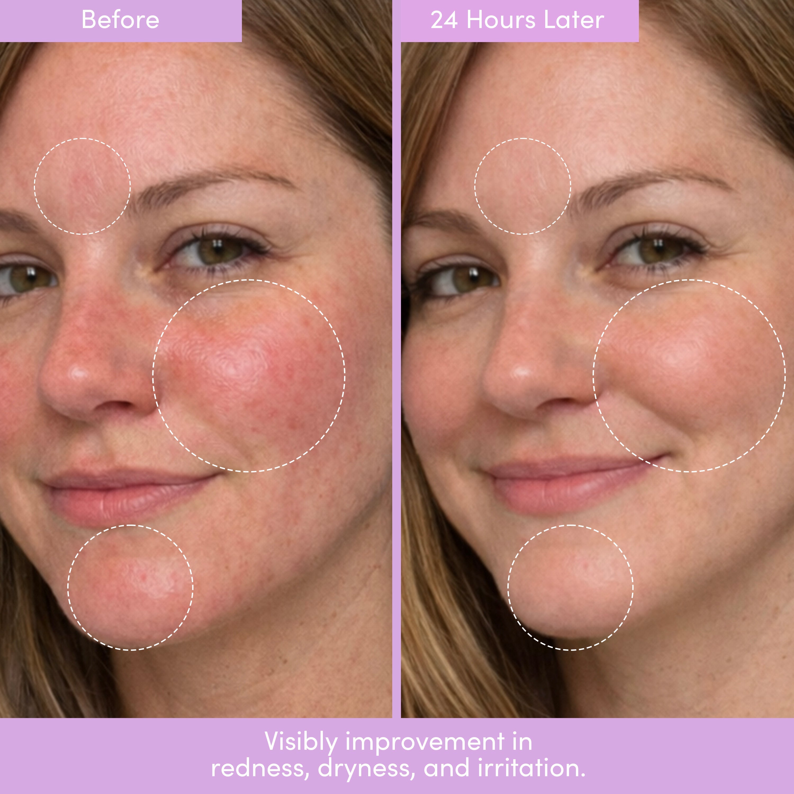 PEP TALK™ Bio-Peptide Barrier Repair Cream with Triple Lipid Complex