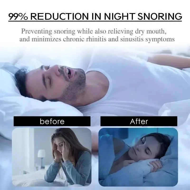Mouth Tape for Sleeping | Anti Snoring Strips for Better Sleep