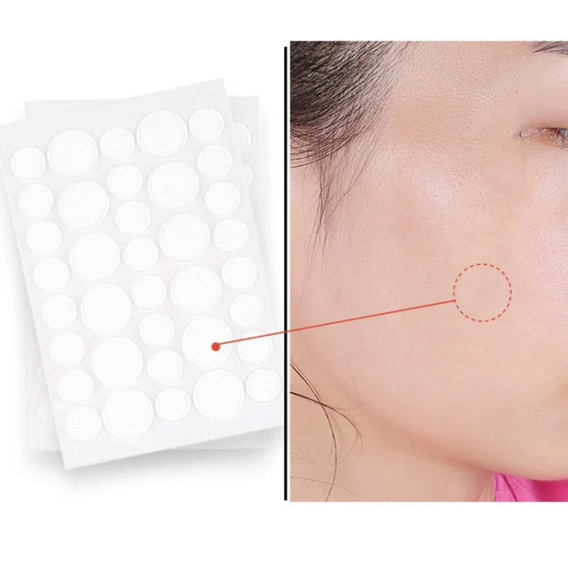 Acne Pimple Patch Invisible Waterproof | Hydrocolloid Spot Treatment for Blemishes